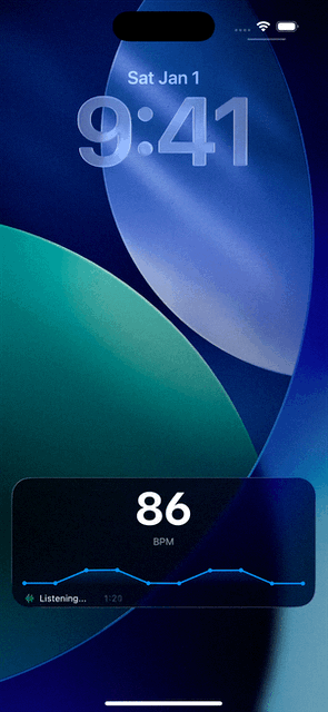 BPM Analyzer Live Activity animation